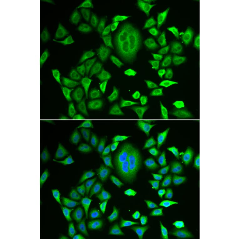 Anti-RBP3 Antibody from Bioworld Technology (BS8191) - Antibodies.com