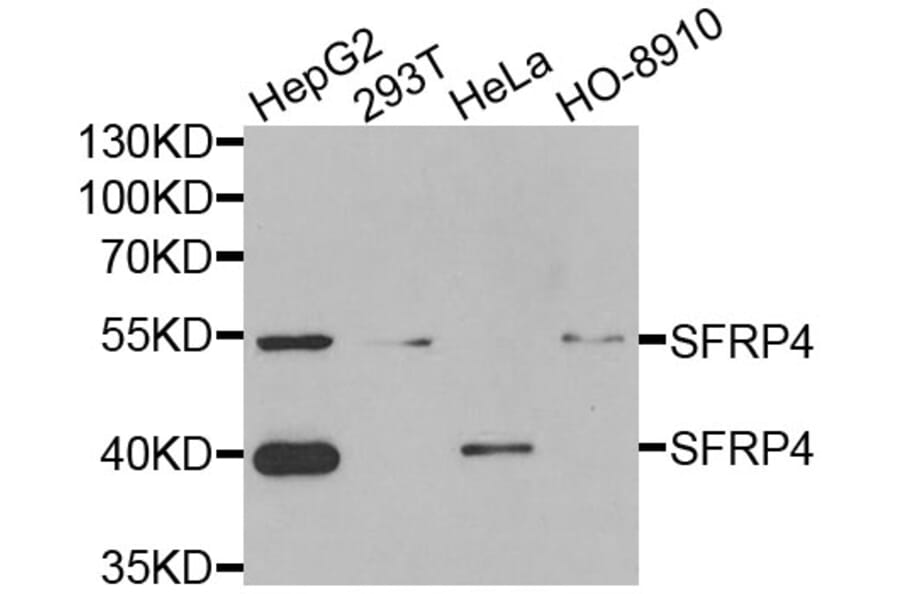 Anti-SFRP4 Antibody from Bioworld Technology (BS8194) - Antibodies.com