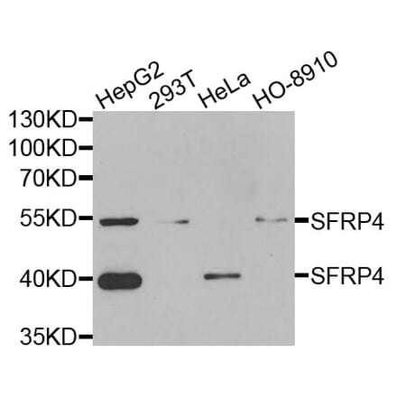Anti-SFRP4 Antibody from Bioworld Technology (BS8194) - Antibodies.com