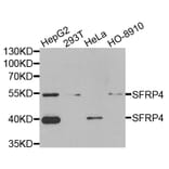 Anti-SFRP4 Antibody from Bioworld Technology (BS8194) - Antibodies.com