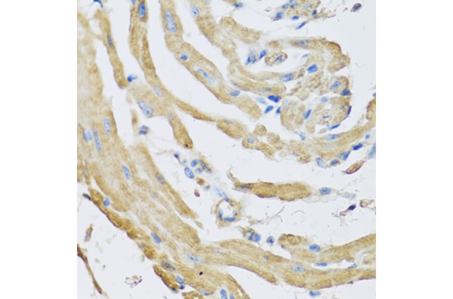 Anti-SFRP4 Antibody from Bioworld Technology (BS8194) - Antibodies.com