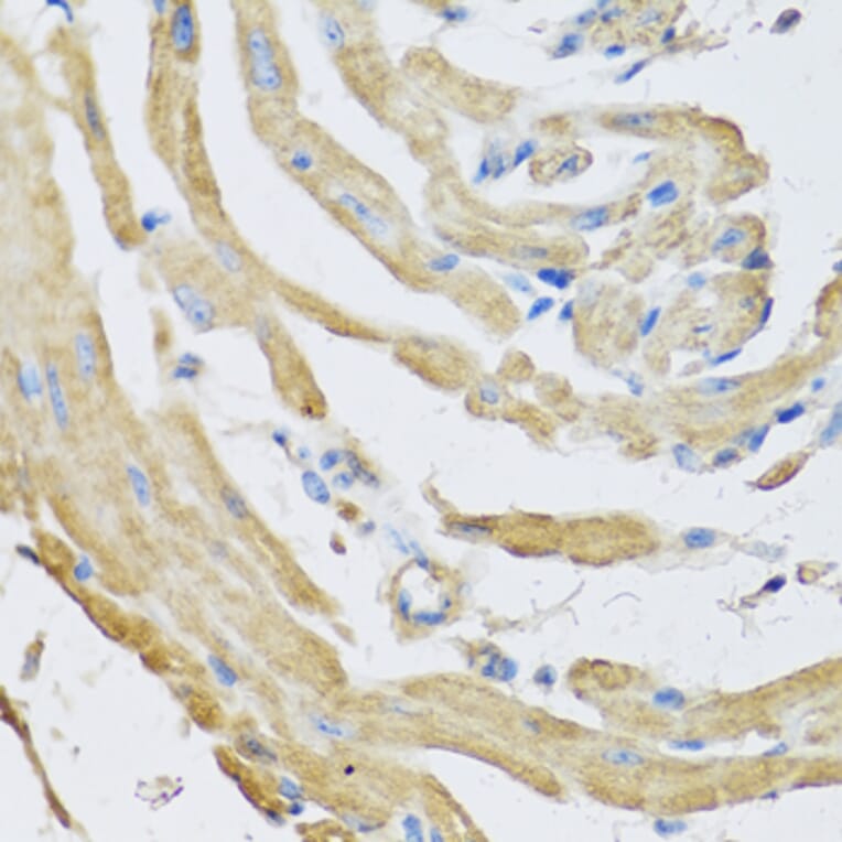 Anti-SFRP4 Antibody from Bioworld Technology (BS8194) - Antibodies.com