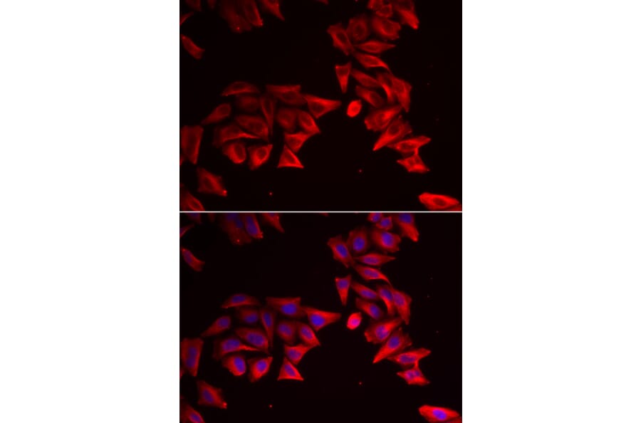 Anti-SFRP4 Antibody from Bioworld Technology (BS8194) - Antibodies.com