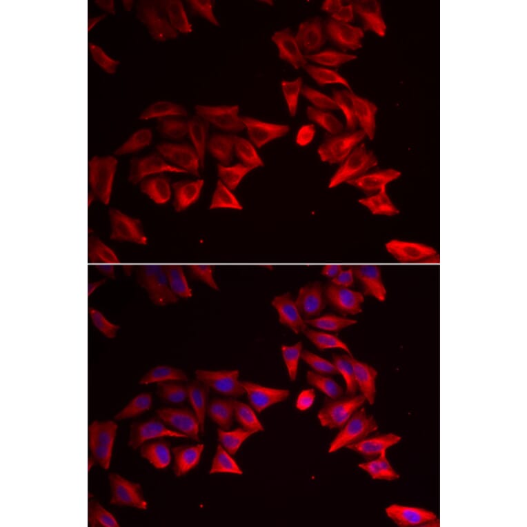 Anti-SFRP4 Antibody from Bioworld Technology (BS8194) - Antibodies.com