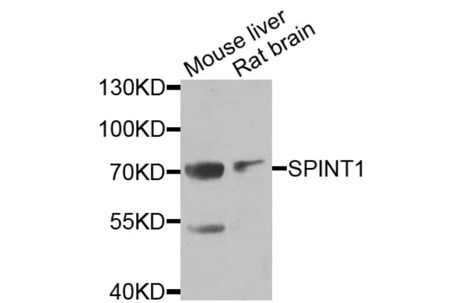 Anti-SPINT1 Antibody from Bioworld Technology (BS8196) - Antibodies.com