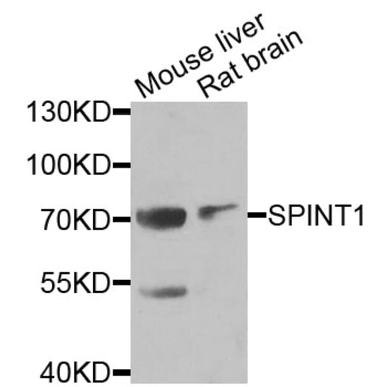 Anti-SPINT1 Antibody from Bioworld Technology (BS8196) - Antibodies.com