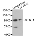 Anti-SPINT1 Antibody from Bioworld Technology (BS8196) - Antibodies.com