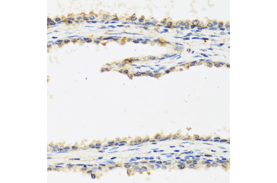 Anti-SPINT1 Antibody from Bioworld Technology (BS8196) - Antibodies.com