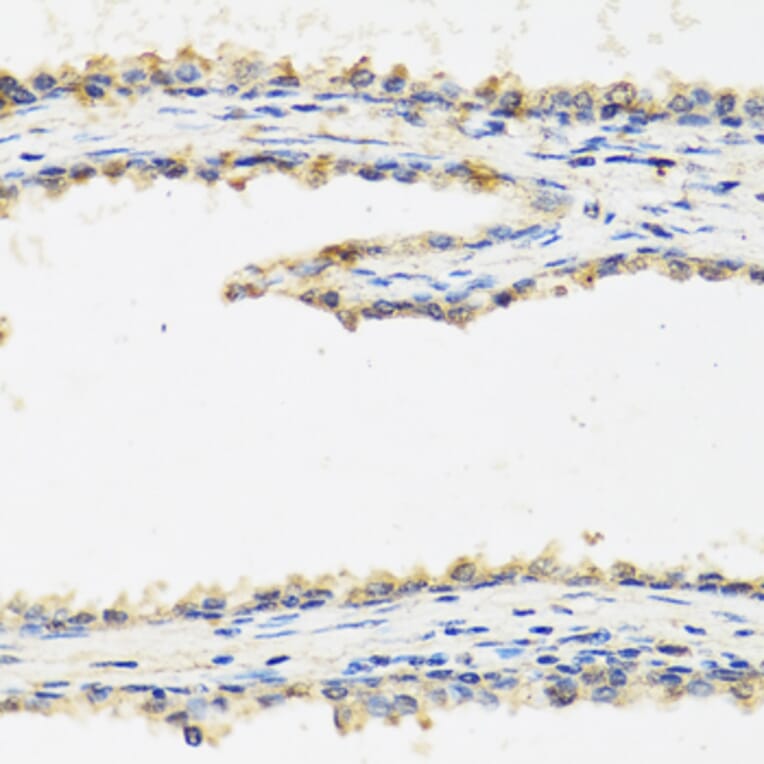 Anti-SPINT1 Antibody from Bioworld Technology (BS8196) - Antibodies.com