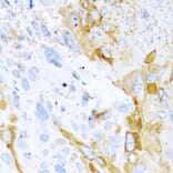 Anti-SPINT1 Antibody from Bioworld Technology (BS8196) - Antibodies.com