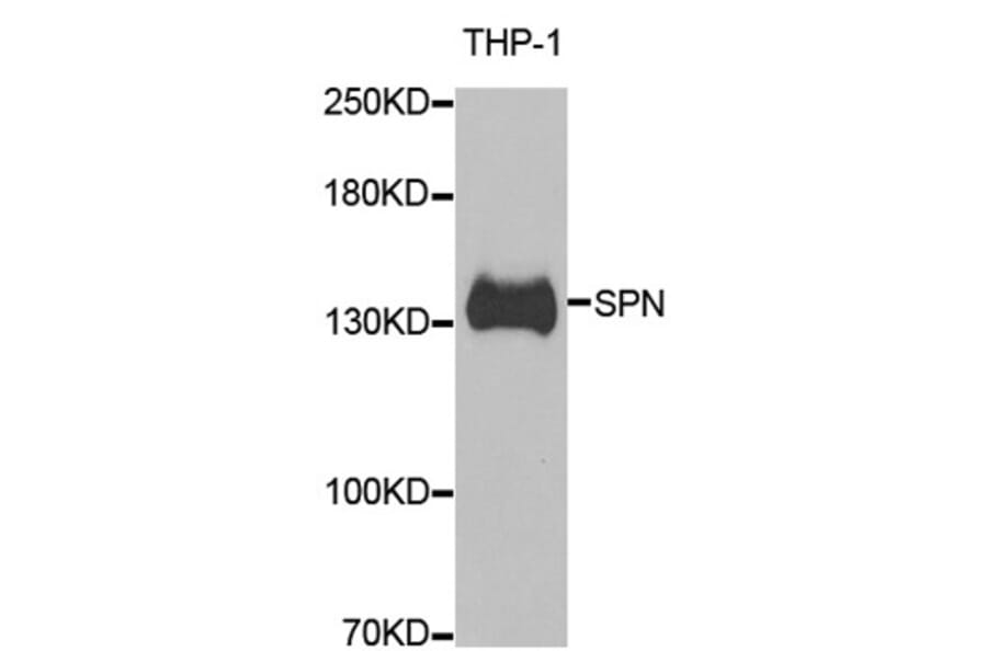 Anti-SPN Antibody from Bioworld Technology (BS8197) - Antibodies.com