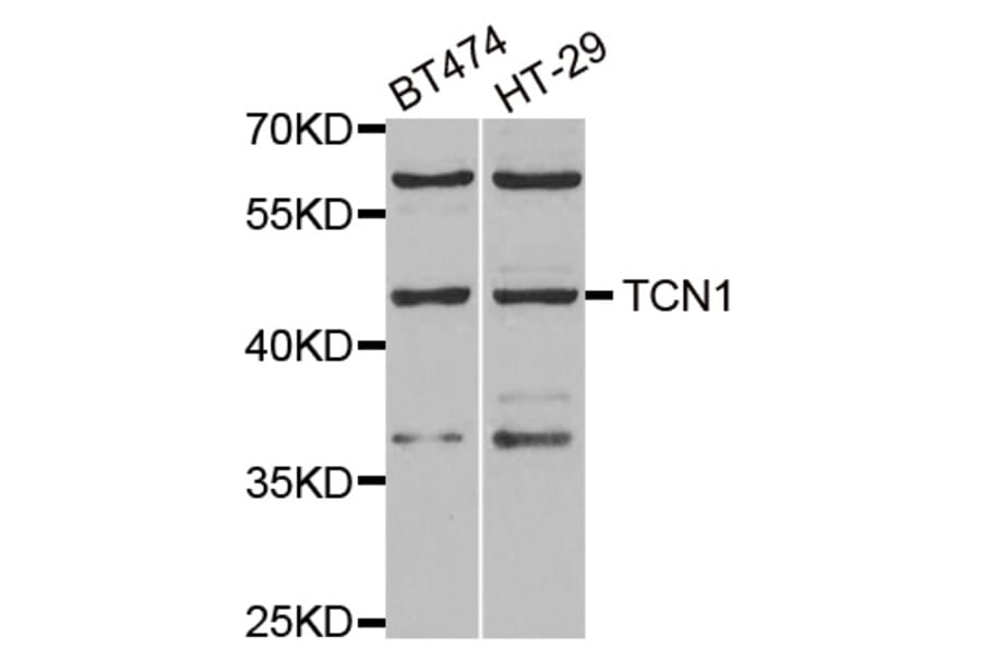 Anti-TCN1 Antibody from Bioworld Technology (BS8199) - Antibodies.com