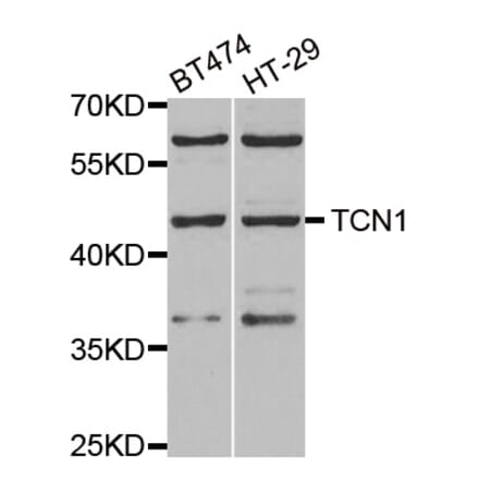 Anti-TCN1 Antibody from Bioworld Technology (BS8199) - Antibodies.com