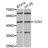 Anti-TCN1 Antibody from Bioworld Technology (BS8199) - Antibodies.com