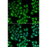 Anti-KLF10 Antibody from Bioworld Technology (BS8200) - Antibodies.com