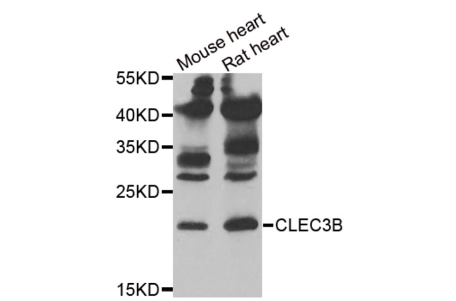 Anti-CLEC3B Antibody from Bioworld Technology (BS8202) - Antibodies.com