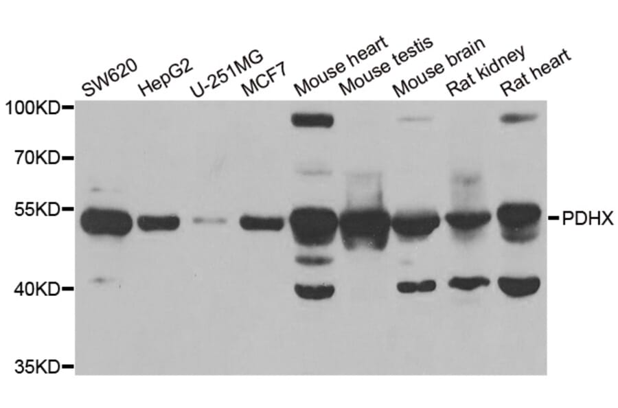 Anti-PDHX Antibody from Bioworld Technology (BS8207) - Antibodies.com