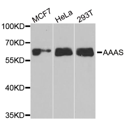 Anti-AAAS Antibody from Bioworld Technology (BS8208) - Antibodies.com