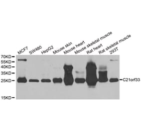 Anti-C21orf33 Antibody from Bioworld Technology (BS8210) - Antibodies.com