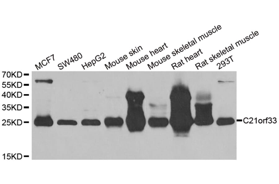 Anti-C21orf33 Antibody from Bioworld Technology (BS8210) - Antibodies.com