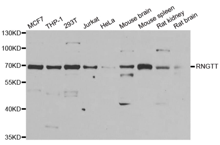 Anti-RNGTT Antibody from Bioworld Technology (BS8211) - Antibodies.com