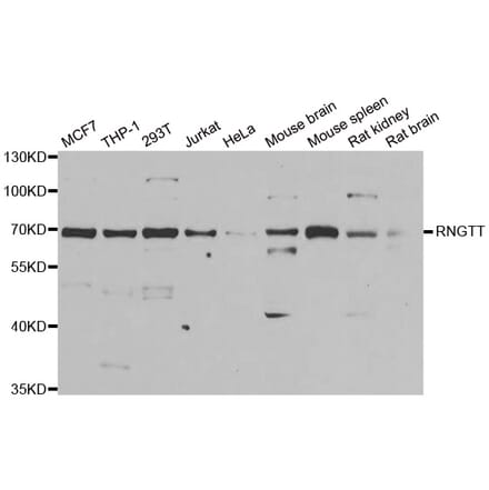 Anti-RNGTT Antibody from Bioworld Technology (BS8211) - Antibodies.com