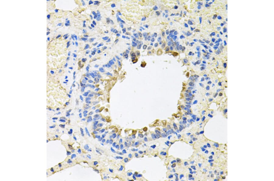 Anti-SKAP2 Antibody from Bioworld Technology (BS8215) - Antibodies.com