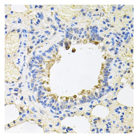 Anti-SKAP2 Antibody from Bioworld Technology (BS8215) - Antibodies.com