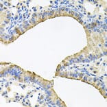 Anti-SKAP2 Antibody from Bioworld Technology (BS8215) - Antibodies.com
