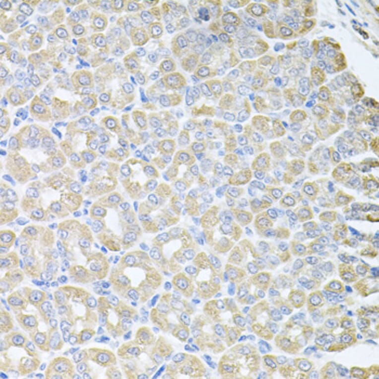 Anti-SKAP2 Antibody from Bioworld Technology (BS8215) - Antibodies.com