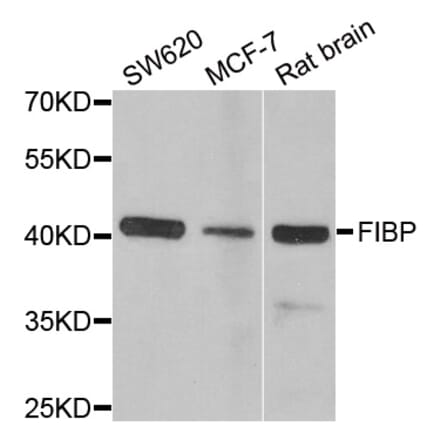 Anti-FIBP Antibody from Bioworld Technology (BS8216) - Antibodies.com