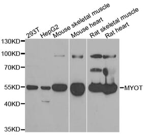 Anti-MYOT Antibody from Bioworld Technology (BS8217) - Antibodies.com