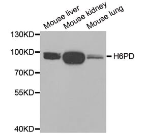 Anti-H6PD Antibody from Bioworld Technology (BS8218) - Antibodies.com