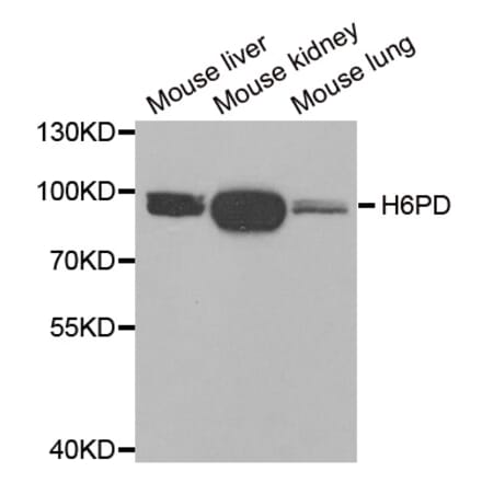 Anti-H6PD Antibody from Bioworld Technology (BS8218) - Antibodies.com