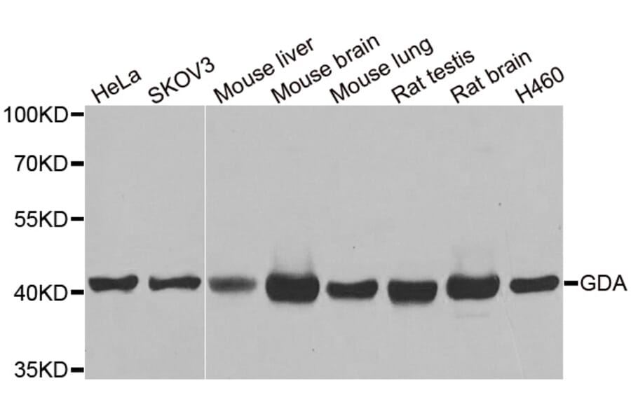 Anti-GDA Antibody from Bioworld Technology (BS8219) - Antibodies.com