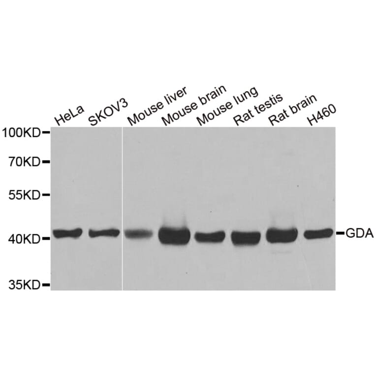 Anti-GDA Antibody from Bioworld Technology (BS8219) - Antibodies.com