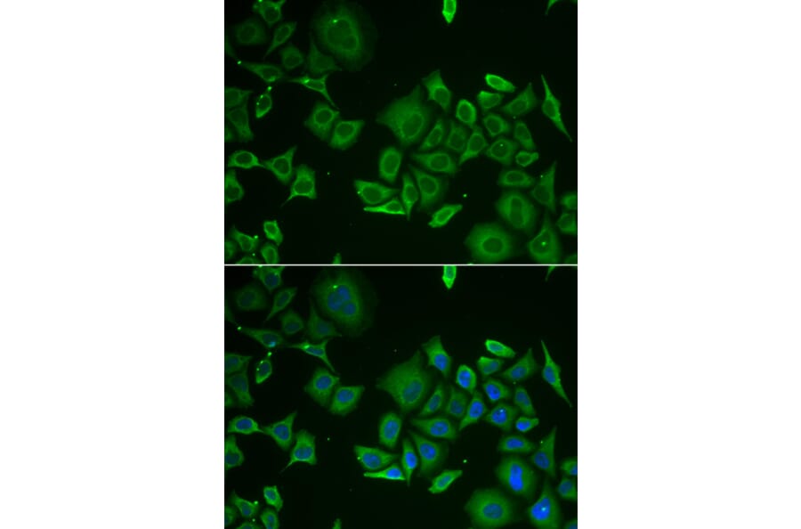 Anti-C1D Antibody from Bioworld Technology (BS8224) - Antibodies.com