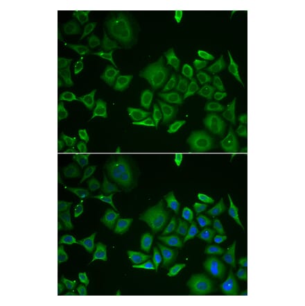 Anti-C1D Antibody from Bioworld Technology (BS8224) - Antibodies.com