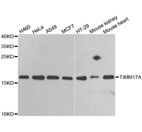 Anti-TIMM17A Antibody from Bioworld Technology (BS8225) - Antibodies.com