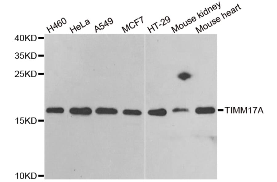 Anti-TIMM17A Antibody from Bioworld Technology (BS8225) - Antibodies.com