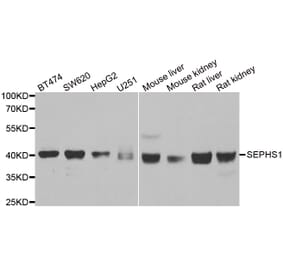 Anti-SEPHS1 Antibody from Bioworld Technology (BS8228) - Antibodies.com