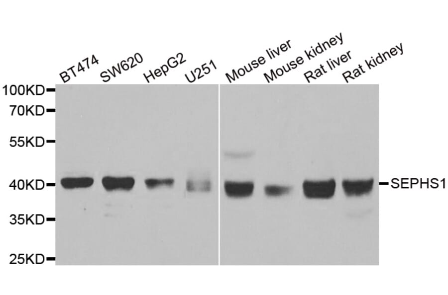 Anti-SEPHS1 Antibody from Bioworld Technology (BS8228) - Antibodies.com