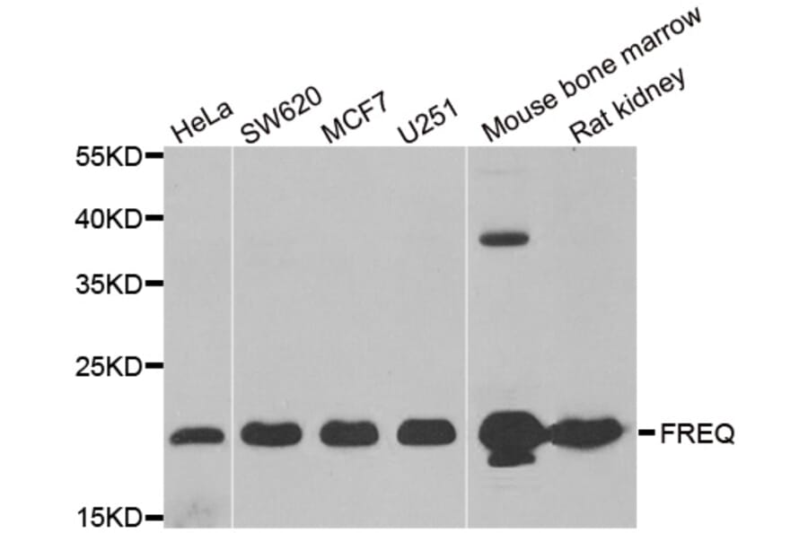 Anti-FREQ Antibody from Bioworld Technology (BS8229) - Antibodies.com