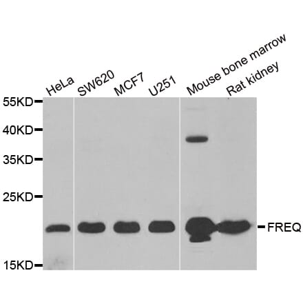 Anti-FREQ Antibody from Bioworld Technology (BS8229) - Antibodies.com