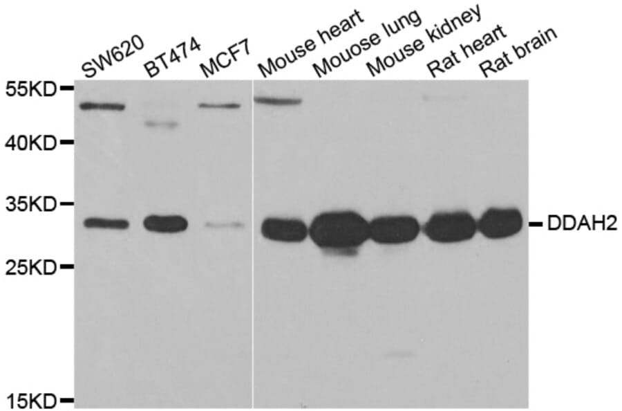 Anti-DDAH2 Antibody from Bioworld Technology (BS8231) - Antibodies.com