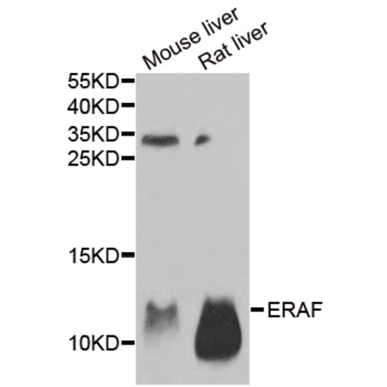 Anti-ERAF Antibody from Bioworld Technology (BS8238) - Antibodies.com