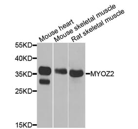 Anti-MYOZ2 Antibody from Bioworld Technology (BS8240) - Antibodies.com