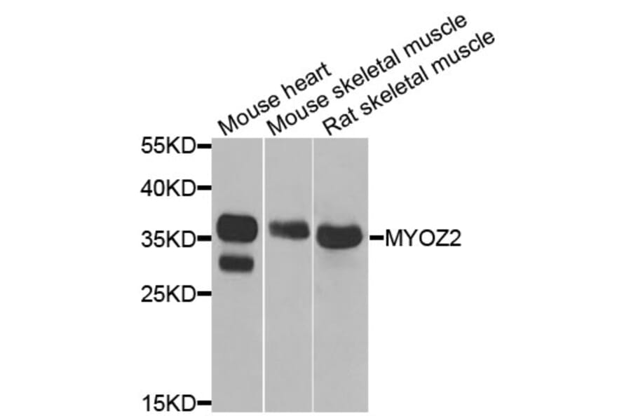 Anti-MYOZ2 Antibody from Bioworld Technology (BS8240) - Antibodies.com