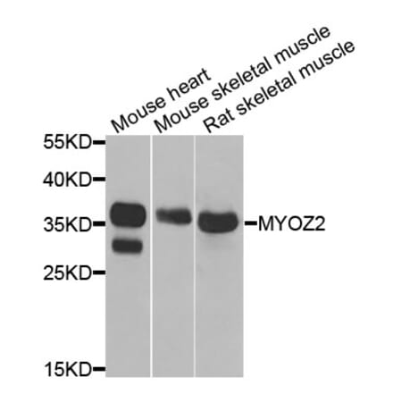 Anti-MYOZ2 Antibody from Bioworld Technology (BS8240) - Antibodies.com