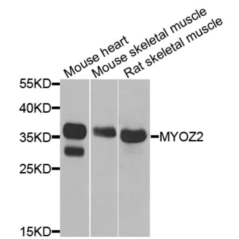 Anti-MYOZ2 Antibody from Bioworld Technology (BS8240) - Antibodies.com